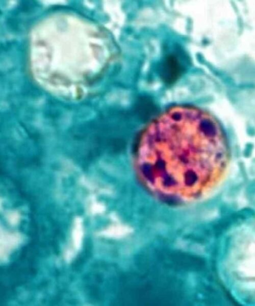 CDC investiga posible vínculo entre brote de ciclosporiasis y restaurantes Taco Bell